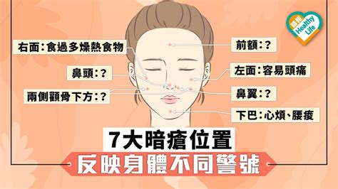 下巴底生暗瘡|下巴暗瘡位置意味什麼？中西醫看法大不同！